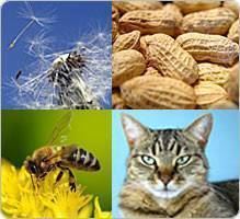 Allergies (vue d'ensemble)