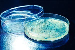 Pourquoi les antibiotiques seront-ils bientôt moins efficaces ?