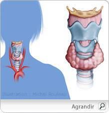 hypothyroidie_pm